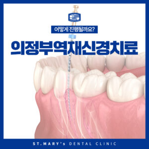의정부역재신경치료