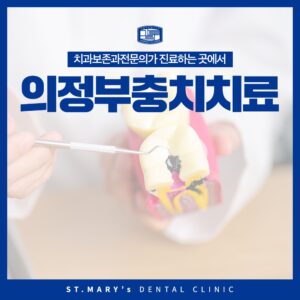 의정부충치치료