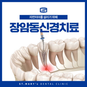 장암동신경치료