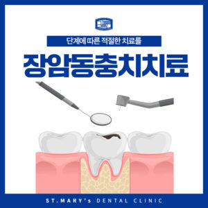 장암동충치치료