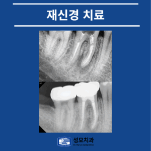 의정부신경치료