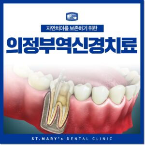 의정부역신경치료