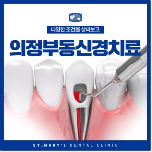 의정부동신경치료