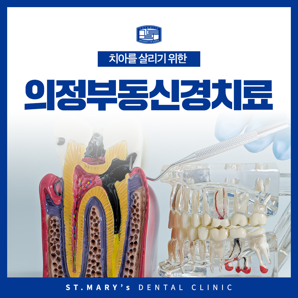 의정부동신경치료