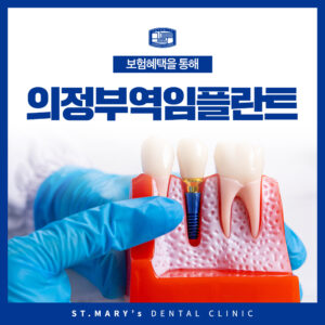 의정부역임플란트