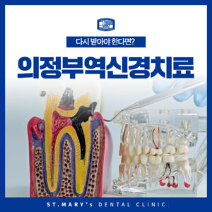 의정부역신경치료