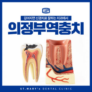 의정부역충치