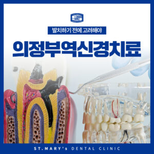 의정부역신경치료