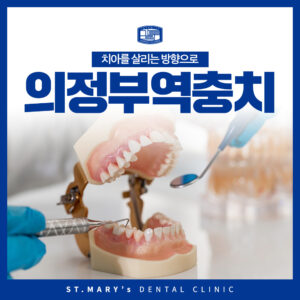 의정부역충치